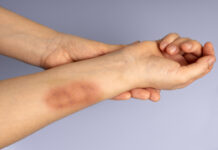 Aggravated assault under United States Law