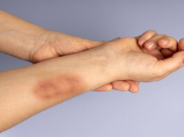 Aggravated assault under United States Law